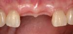 �C���v�����g �ԍ�̎��Ȉ�@ ���R�f���^���I�t�B�X �C���v�����g�Ǘ�2�P